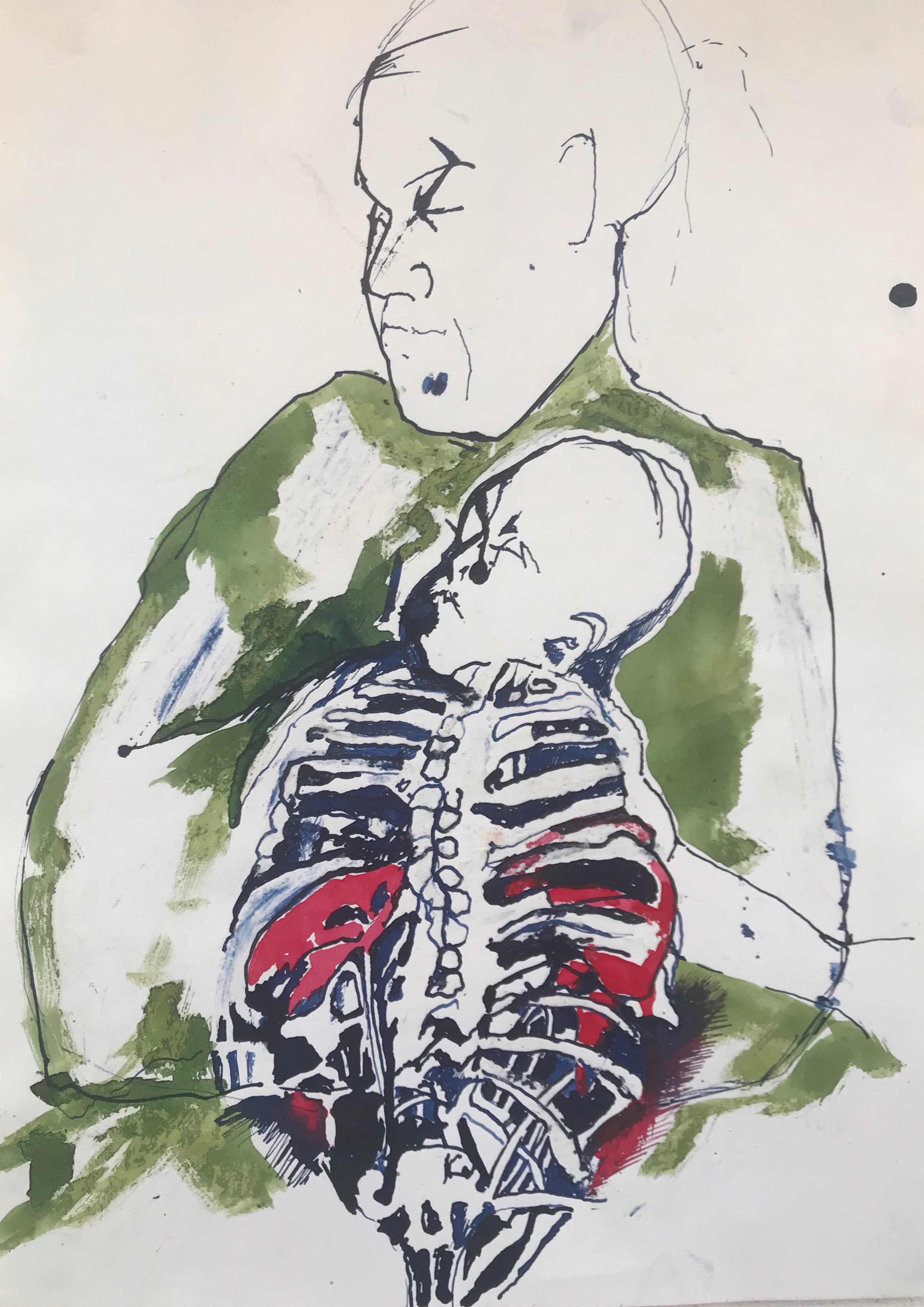 kidney diagnosis
